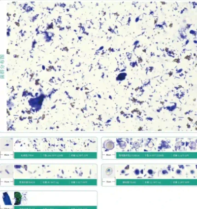 Manual Microscopic Examination