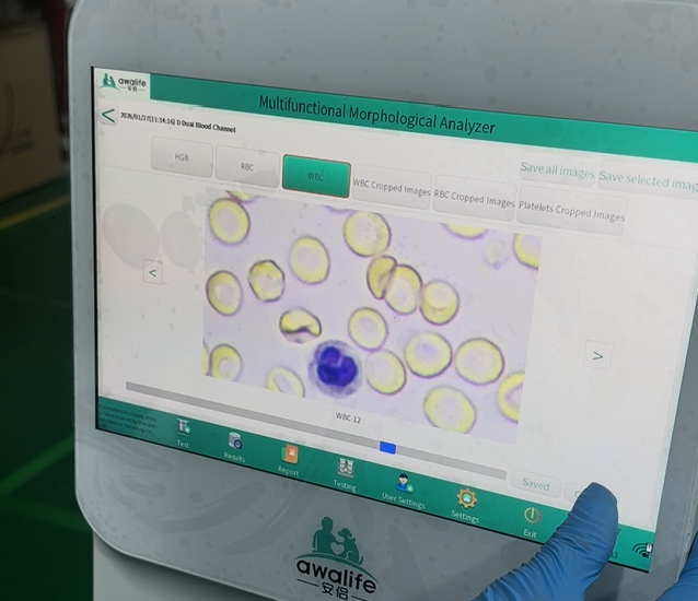 Software and Algorithm Iteration